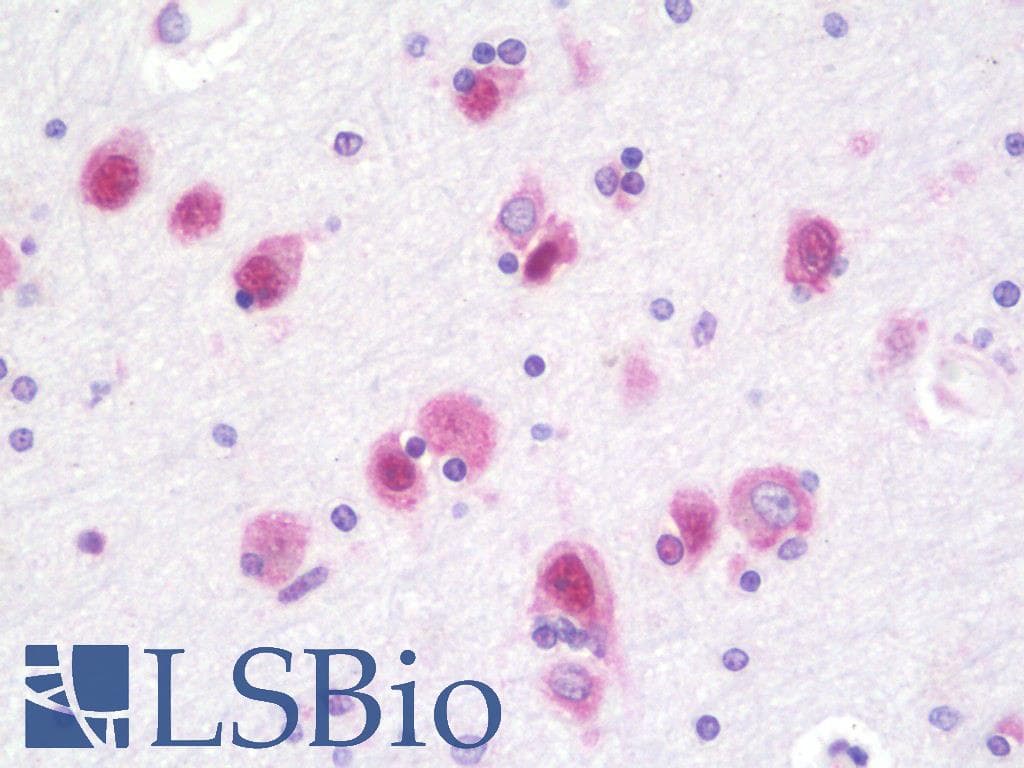 IHC-plus™ Monoclonal Mouse anti-Human PSMA7 Antibody (clone 1A10-3G12, IHC, IF, WB)
