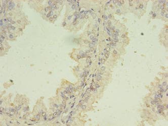SNRPB2 Antibody (aa1-225)