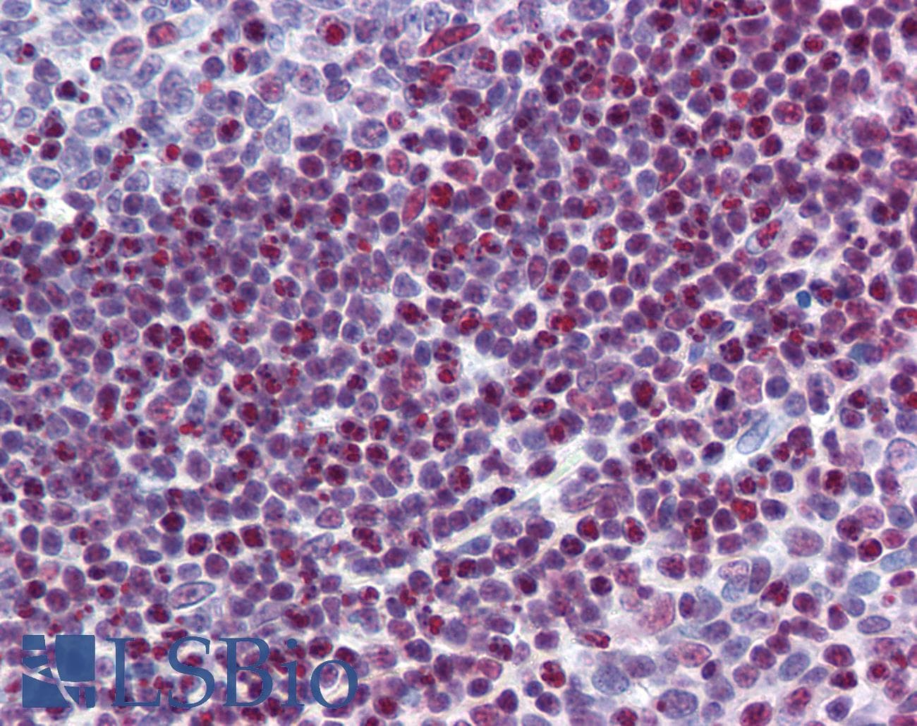 SRSF6 / SRP55 Antibody (aa143-192)