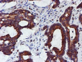 MEF2C Antibody (clone OTI4G8)