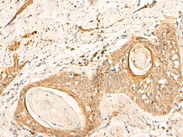 EIF3C / EIF3S8 Antibody