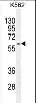 KRT73 / Keratin 73 Antibody (aa493-522)