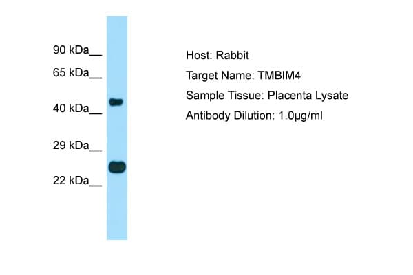 Polyclonal Rabbit anti-Human TMBIM4 / GAAP Antibody (aa110-159, WB)