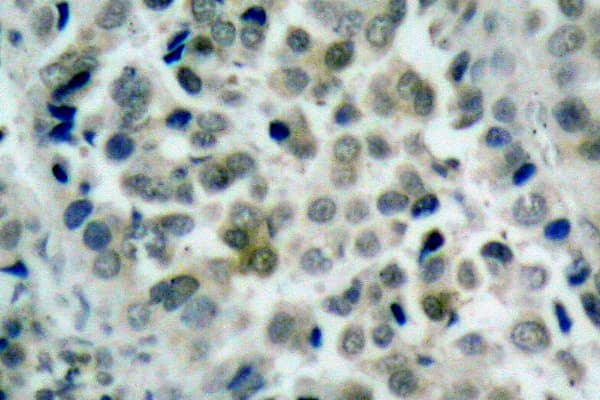 Polyclonal Rabbit anti-Human HDAC8 Antibody (Lys33, IHC, WB)