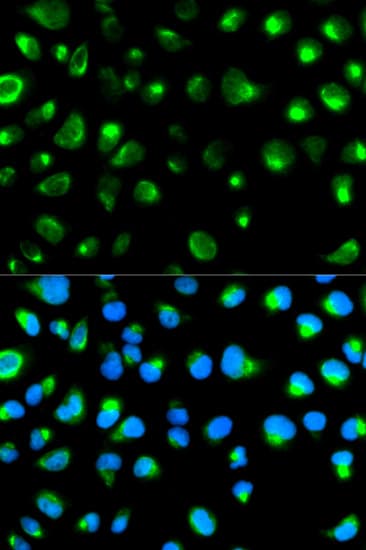 GYPC / Glycophorin C Antibody