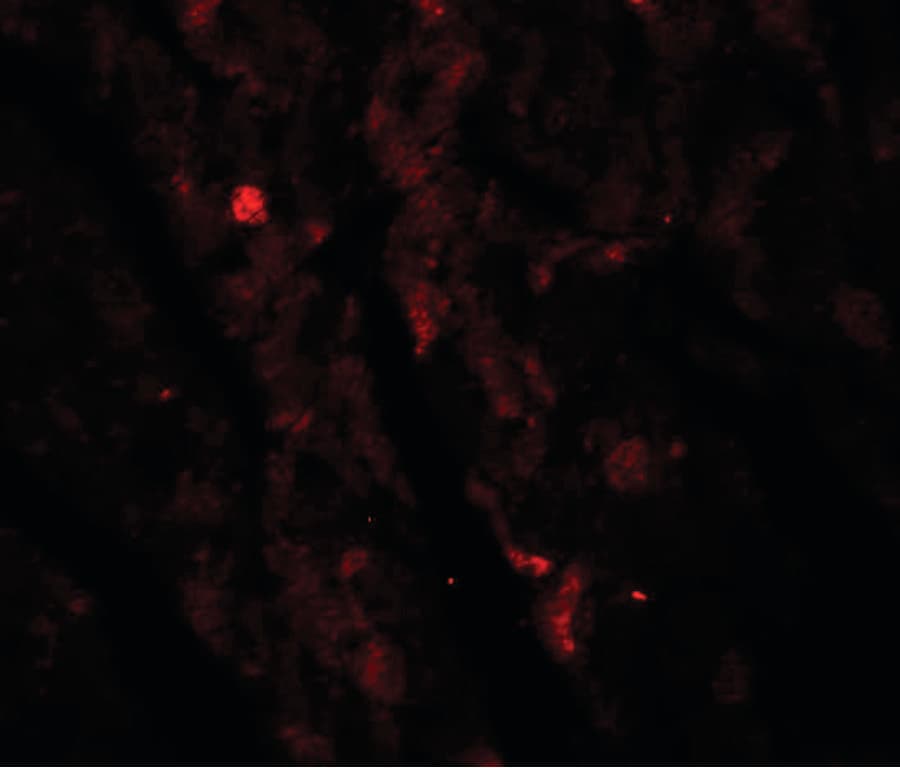 Polyclonal Rabbit anti-Human IDH2 Antibody (IHC, IF, WB)