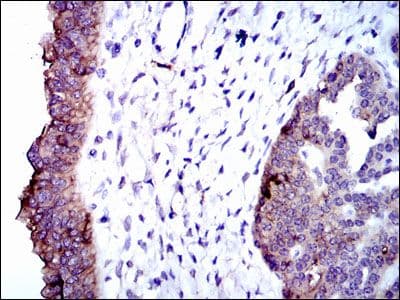 Monoclonal Mouse anti-Human ALPL / Alkaline Phosphatase Antibody (clone 2F4, IHC, WB)