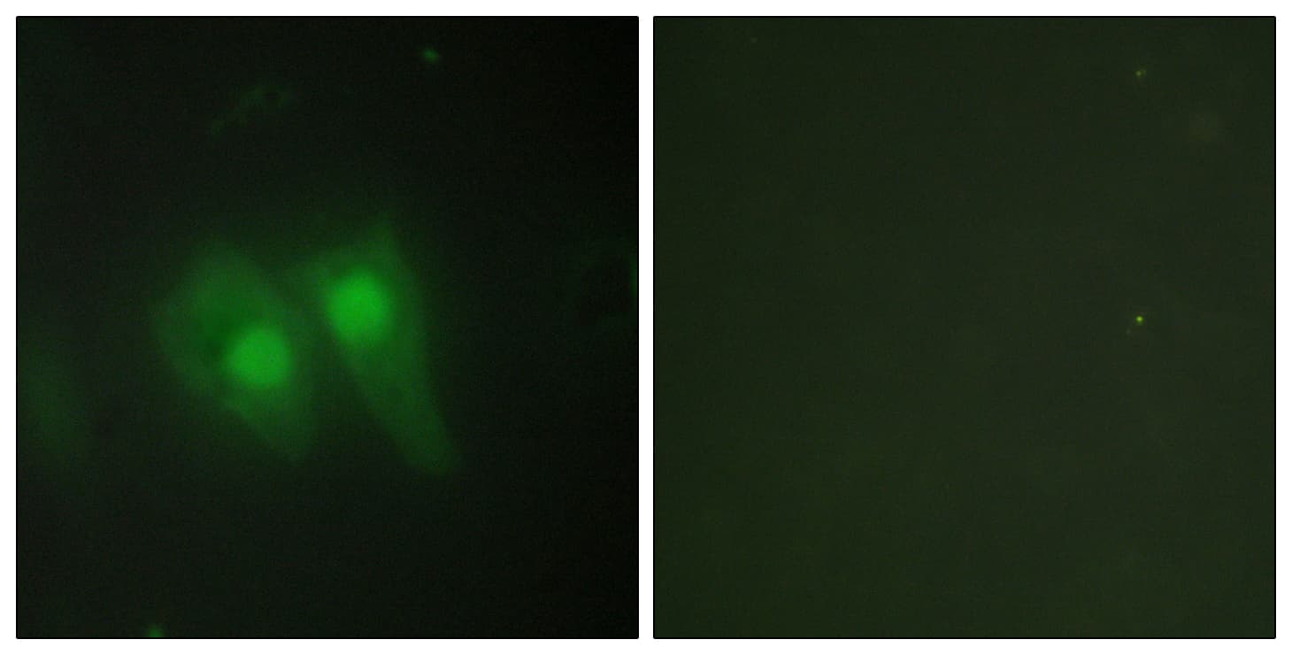 Polyclonal Rabbit anti-Human TSAP6 / STEAP3 Antibody (aa421-470, IF, WB)