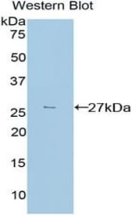 TGFBI Antibody (aa423-632)