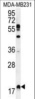 Polyclonal Rabbit anti-Human RHEB Antibody (aa104-134, IHC, WB)