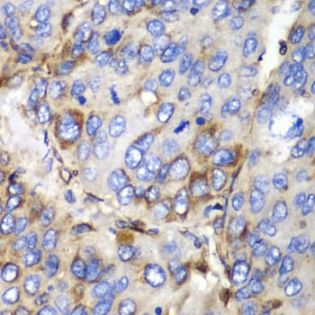 Polyclonal Rabbit anti-Human Osteonectin / SPARC Antibody (IHC, WB)