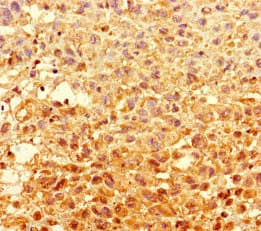 GCD / GCDH Antibody