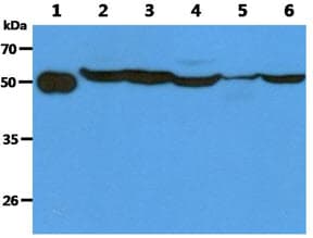 Monoclonal Mouse anti-Human TBCEL / E-Like Antibody (clone AT1B10, WB)