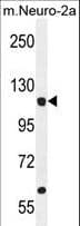 LARS / Leucyl-TRNA Synthetase Antibody (aa176-205)