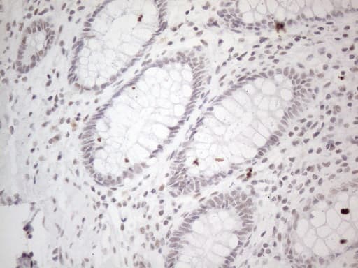 NR2C2 / TAK1 Antibody (aa1-241, clone OTI2H2)