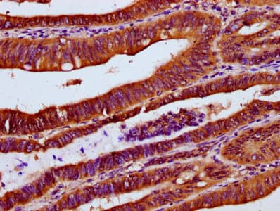 Polyclonal Rabbit anti-Human UBAC2 Antibody (IHC)