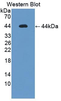 IL12RB1 / CD212 Antibody (aa197-348)