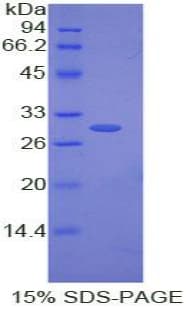 Rat GJA5 / CX40 / Connexin 40 Protein (Recombinant His)