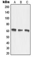Polyclonal Rabbit anti-Human MMP15 Antibody (Internal, WB)