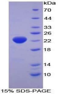 Human IFNA2 / Interferon Alpha 2 Protein (Recombinant His-T7)