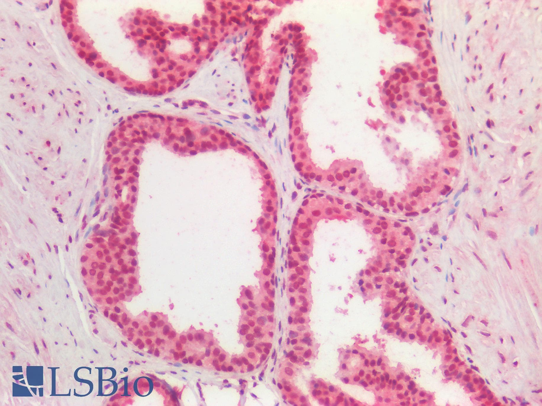 PathPlus™ CDKN1C / p57 Kip2 Antibody