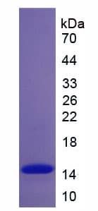 Human CFB / Complement Factor B Protein (Recombinant His)
