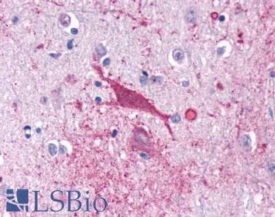 PathPlus™ Polyclonal Rabbit anti-Human CNR1 / CB1 Antibody (C-Terminus, IHC)
