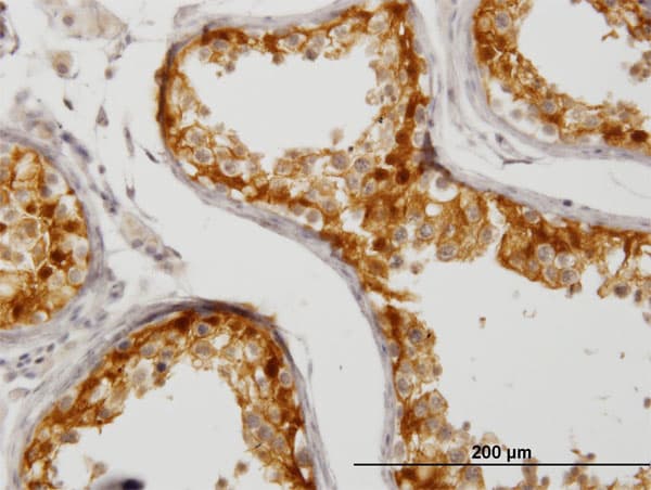 Monoclonal Mouse anti-Human CITED1 Antibody (clone 5H6, IHC, WB)