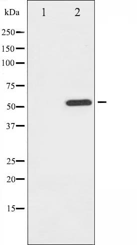 ATF2 Antibody (phospho-Ser112,pSer94)