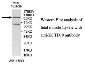 KCTD19 Antibody (aa281-476)