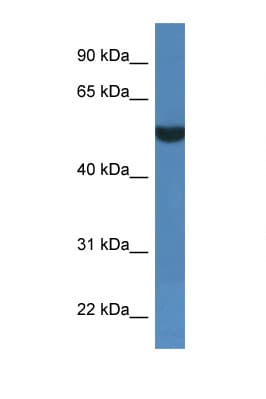 FSD1L Antibody (aa328-377)