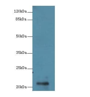 RBBP9 Antibody