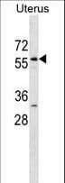 Polyclonal Rabbit anti-Human LEMD2 Antibody (aa10-39, WB)