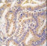 Polyclonal Rabbit anti-Human APG12 / ATG12 Antibody (aa1-30, IHC, IF, WB)