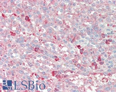 IHC-plus™ MYDGF / SF20 Antibody (aa32-173)