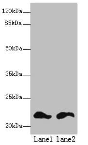 Polyclonal Rabbit anti-Human FKBP11 Antibody (IHC, WB)