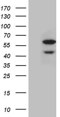 CDY2B Antibody (clone OTI5E1)
