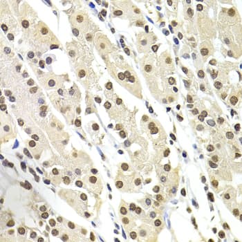 Polyclonal Rabbit anti-Human SOX5 Antibody (aa1-120, IHC, IF, WB)