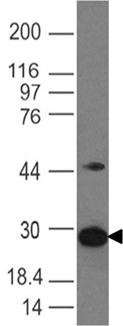 ARHGDIB / D4 GDI Antibody