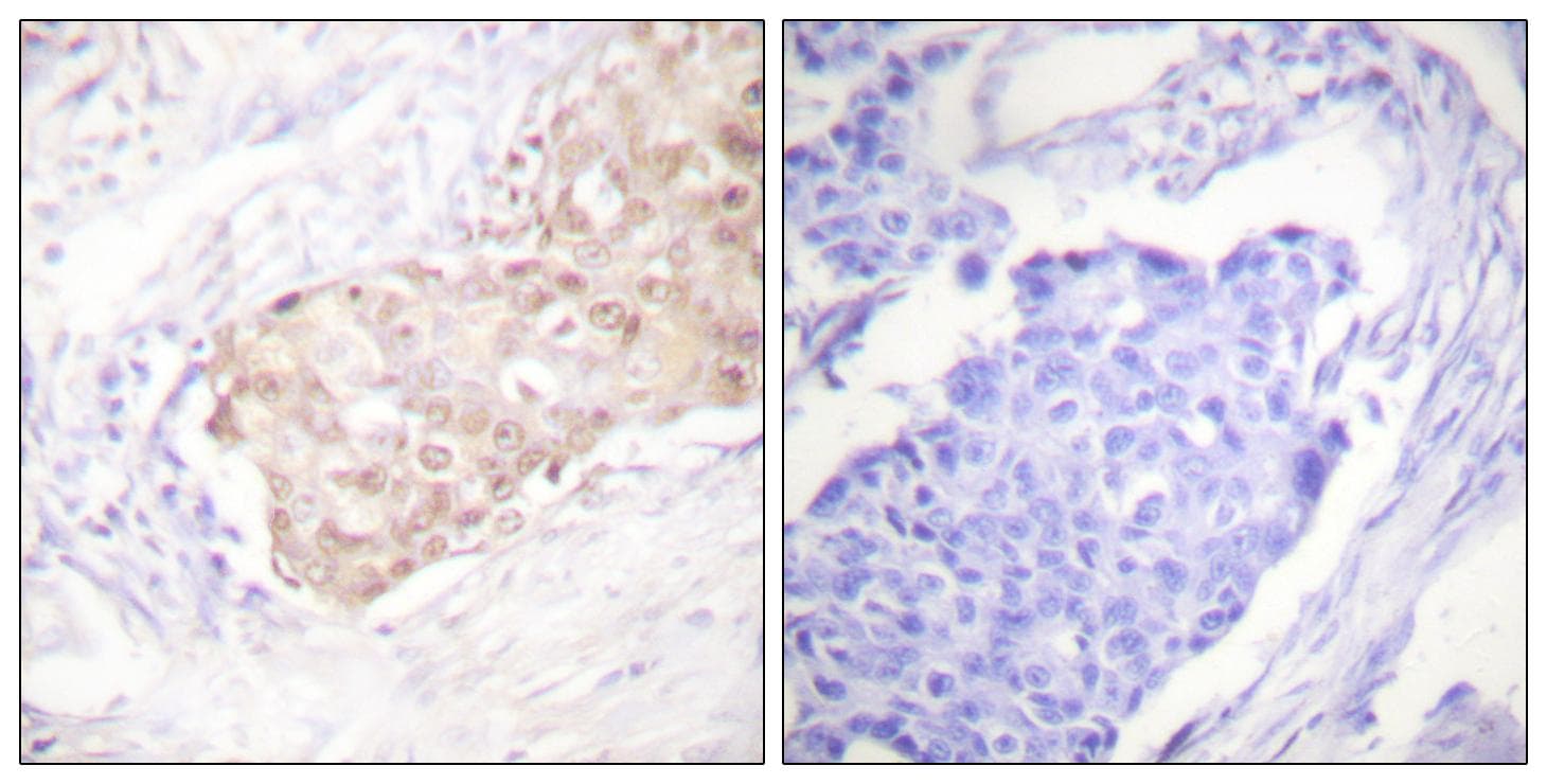 Polyclonal Rabbit anti-Human NEP / DDR1 Antibody (IHC, WB)