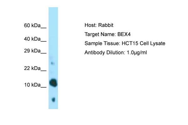 Polyclonal Rabbit anti-Human BEX4 Antibody (aa28-77, WB)