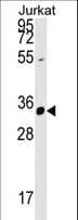 Polyclonal Rabbit anti-Human ZFYVE27 / Protrudin Antibody (aa28-56, WB)