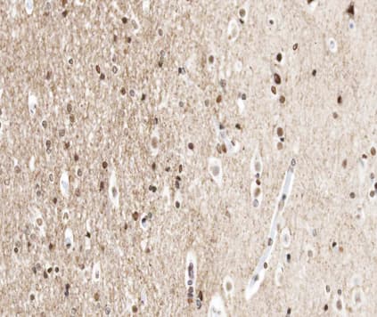 Polyclonal Rabbit anti-Human UBA52 Antibody (IHC, IF, WB)
