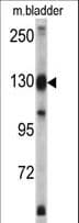 XPO1 / CRM1 Antibody (aa817-846)