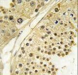 Polyclonal Rabbit anti-Human AURKB / Aurora-B Antibody (aa6-35, IHC, WB)