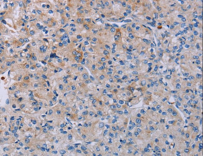 P2RY2 / P2Y2 Antibody