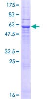 Human SFXN1 Protein (Recombinant GST)