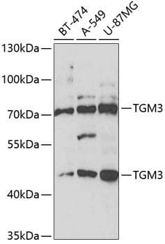 TGM3 / Transglutaminase 3 Antibody
