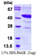 Human DHODH Protein (Recombinant His)
