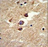 Polyclonal Rabbit anti-Human ALDH5A1 Antibody (IHC, WB)